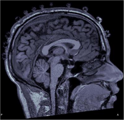 Semi-Automated and Direct Localization and Labeling of EEG Electrodes Using MR Structural Images for Simultaneous fMRI-EEG